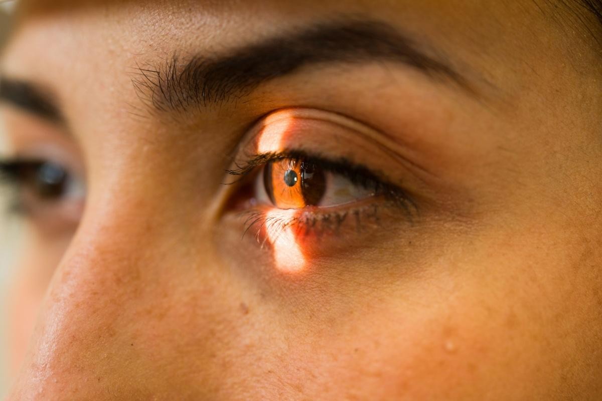 Close-up of a person’s eye illuminated by a narrow beam of light, highlighting the iris and inner eye during an examination.